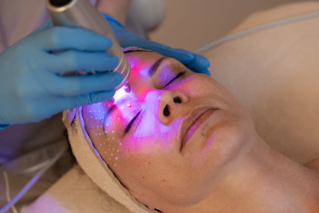 Modella effettua un trattamento laser per la pelle del viso nella spa Beauty Farm di Bibione Thermae