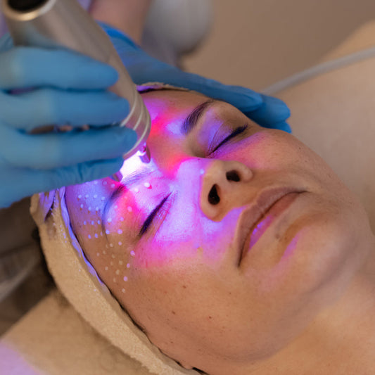 phormalaser trattamento antiage con laser modella donna crema viso